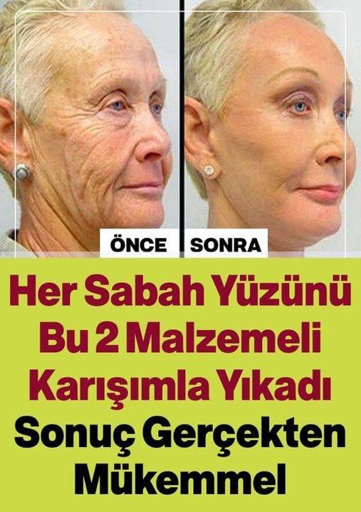 Her Sabah Yüzünü Bu 2 Malzemeli Karışımla Yıkadı Sonuç Gerçekten Mükemmel