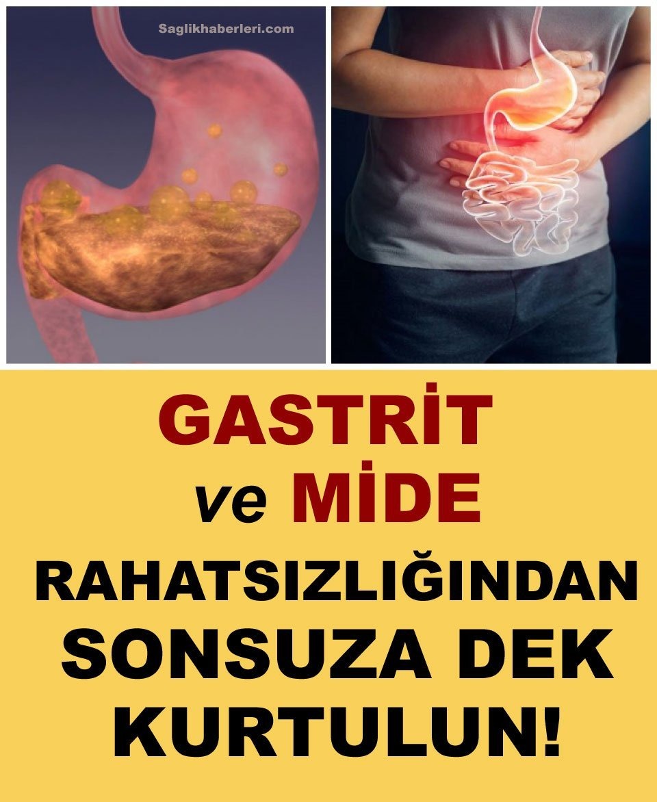Gastrit ve mide ekşimesi probleminde