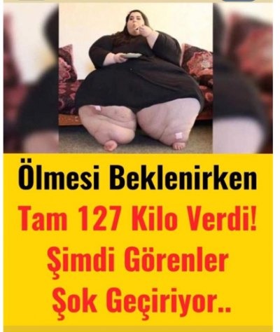 Sayısız Estetik Ameliyat Oldu İşte Son Görünüşü
