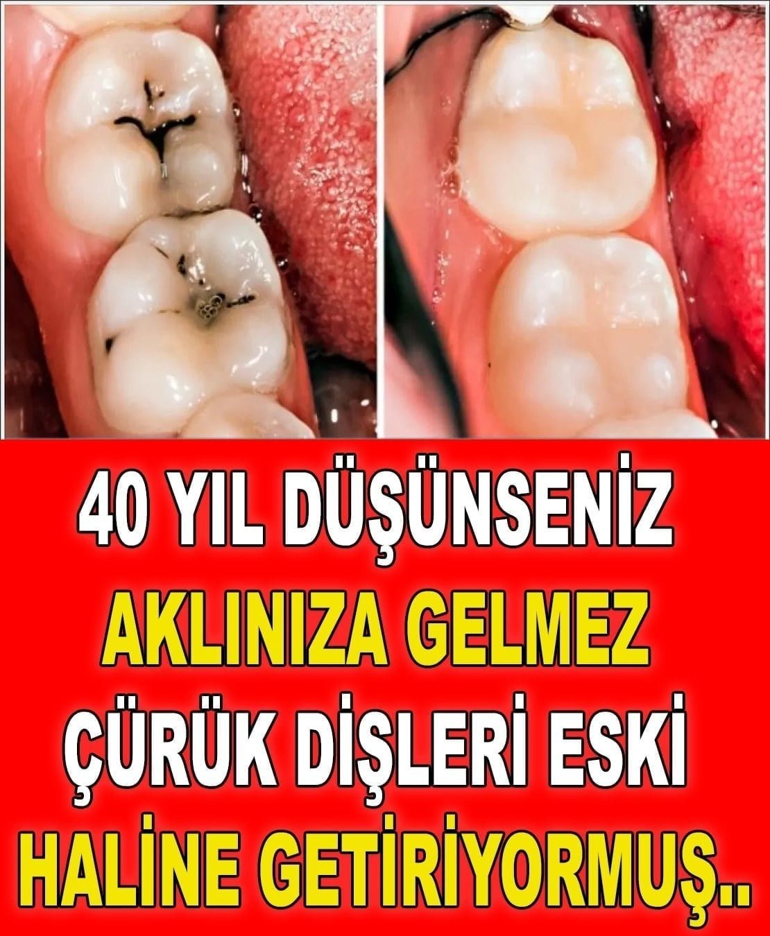 Kırk yıl düşünseniz aklınıza gelmez, çürük dişleri eski haline getiriyor!